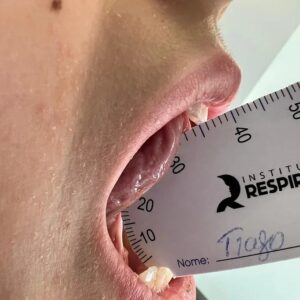 10uni Régua de avaliação funcional