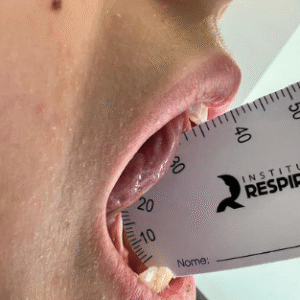 10uni Régua de avaliação funcional